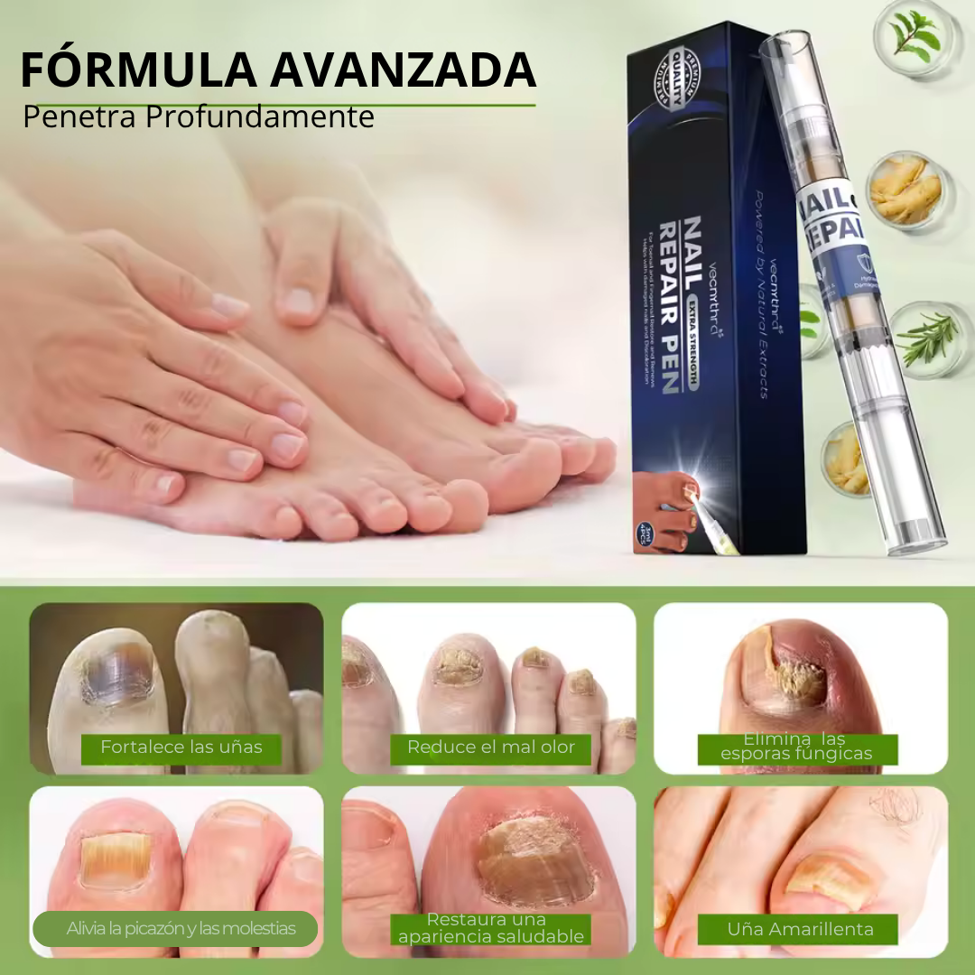MyCurePro® · Elimina hongos en pies y manos · 7 días