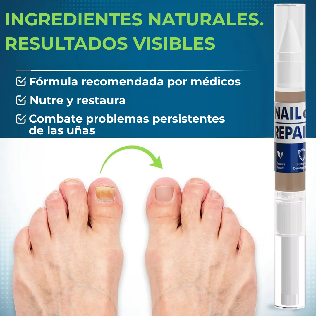 MyCurePro® · Elimina hongos en pies y manos · 7 días