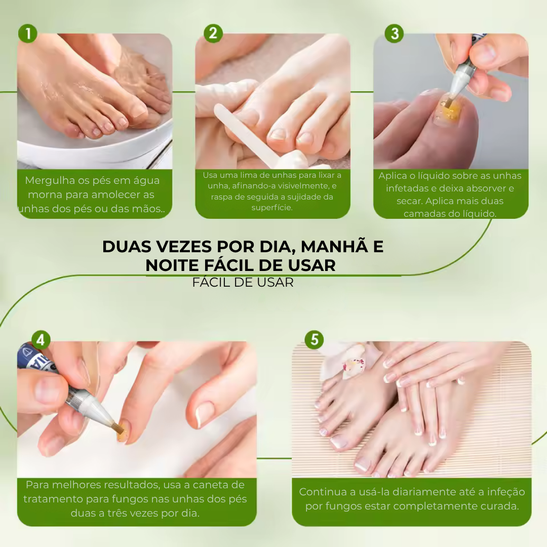 MyCurePro® · Elimina Fungos nos Pés e Mãos · 7 Dias