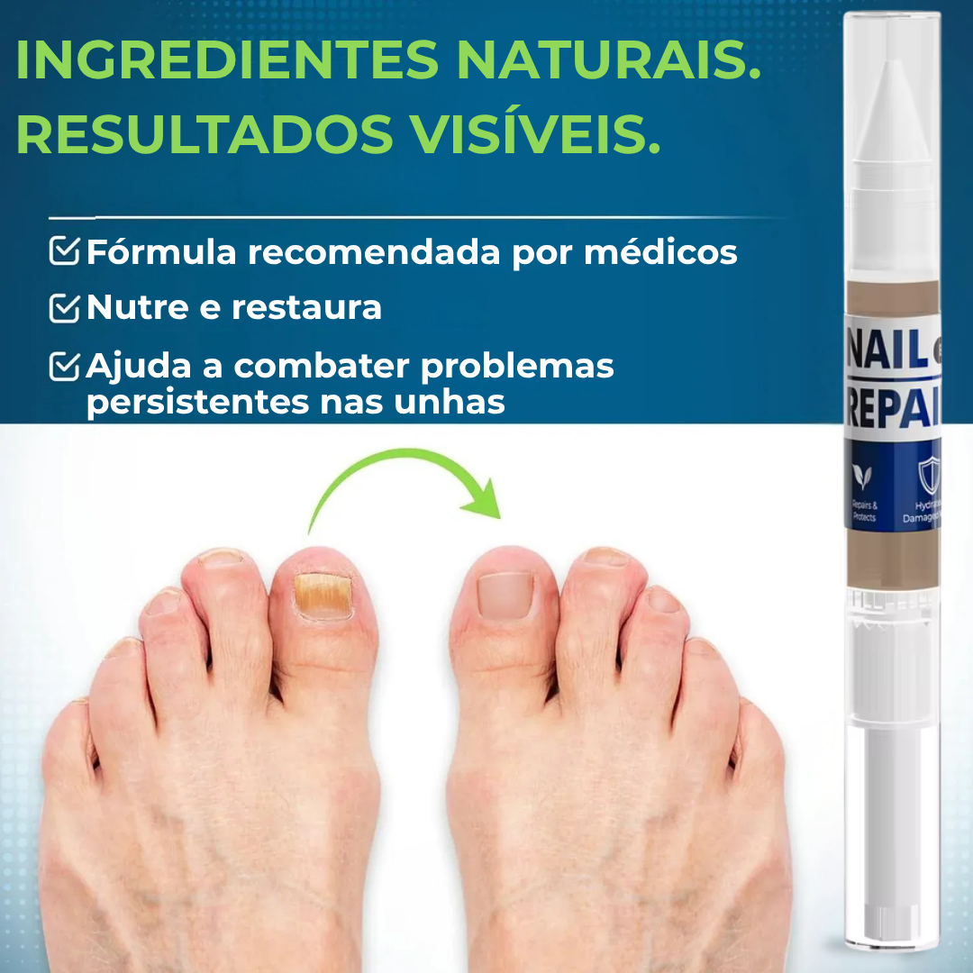 MyCurePro® · Elimina Fungos nos Pés e Mãos · 7 Dias