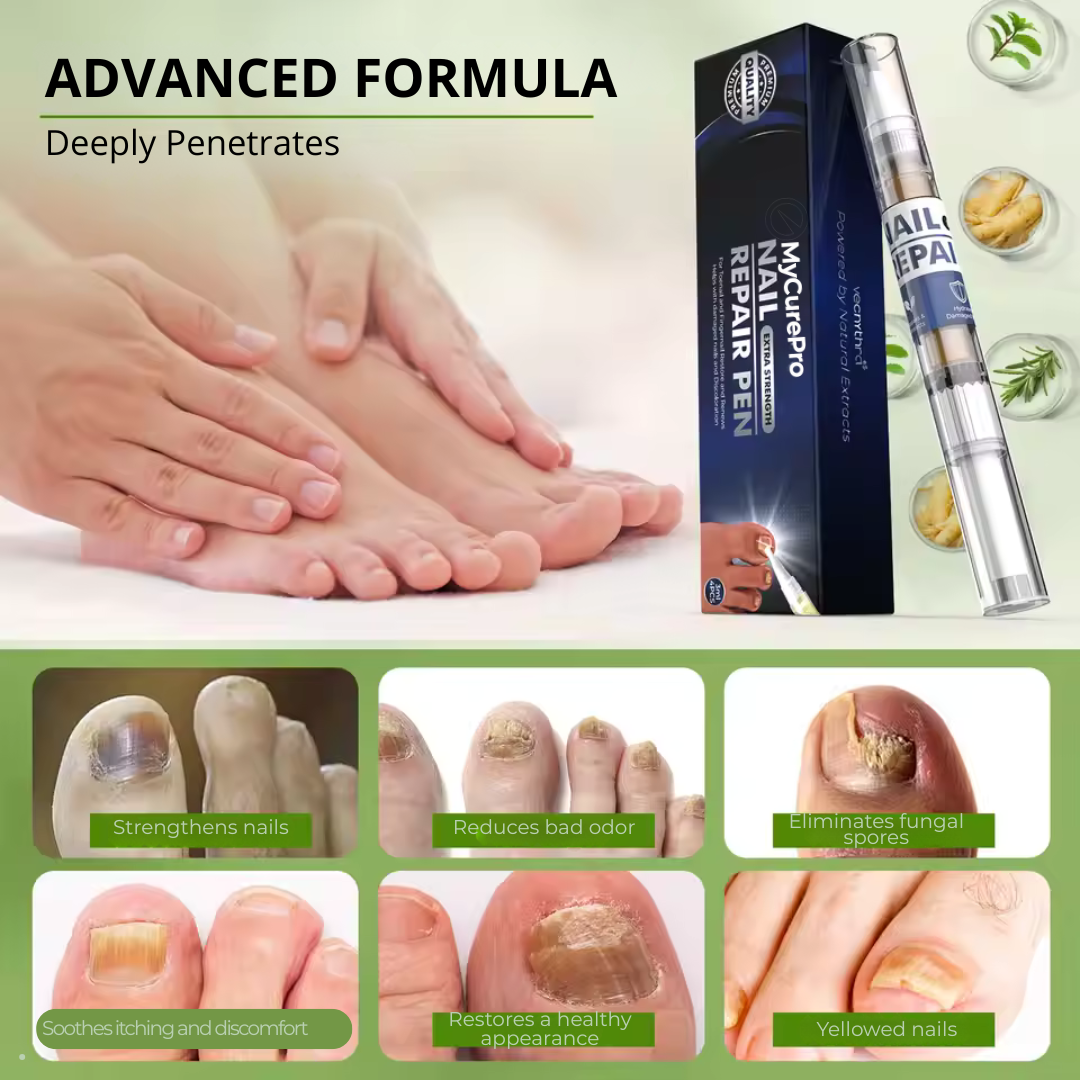 MyCurePro® · Clears Foot & Hand Fungus · 7 Days