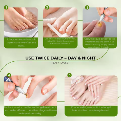 MyCurePro® · Eliminates fungi on feet and hands · 7 days