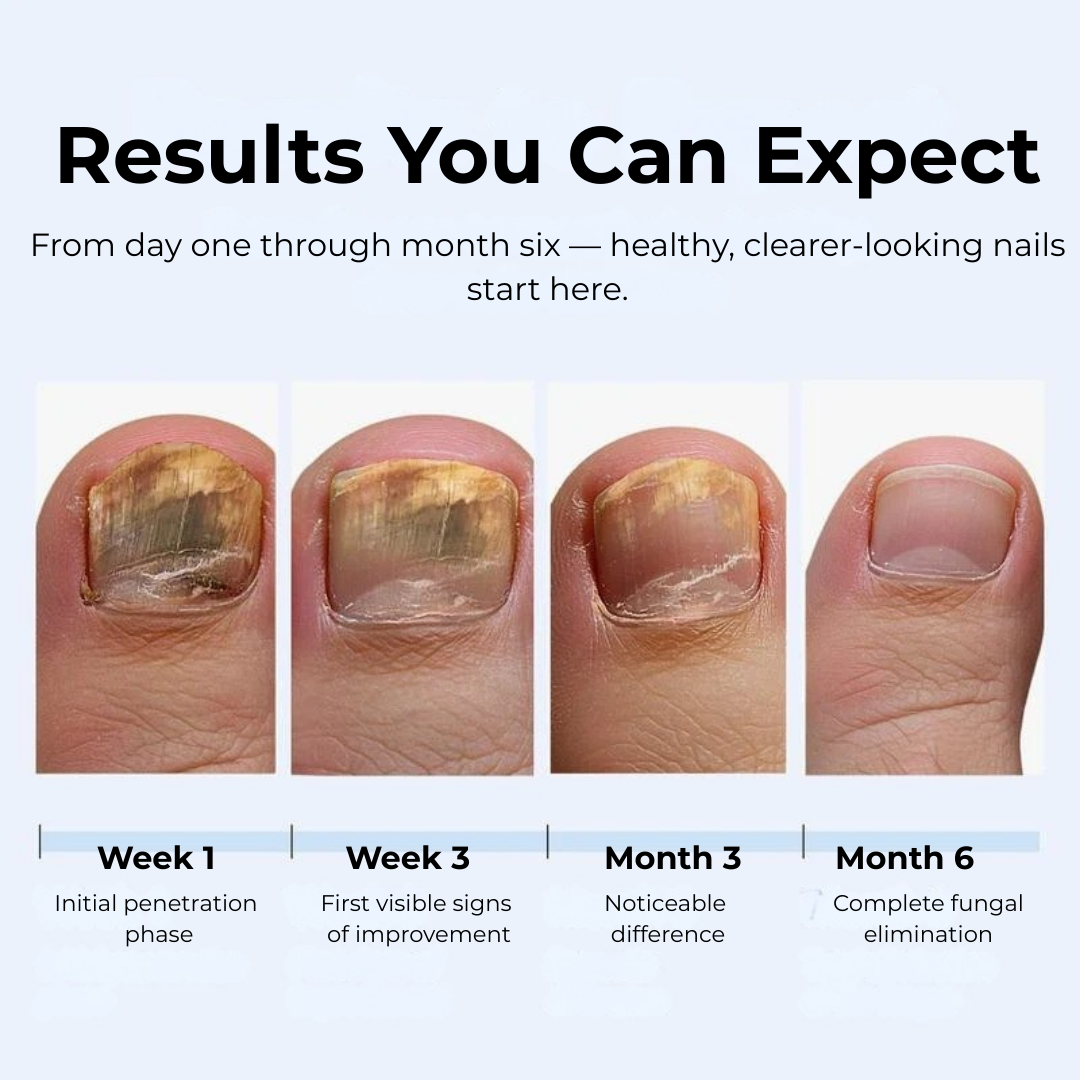 MyCurePro® · Clears Foot & Hand Fungus · 7 Days