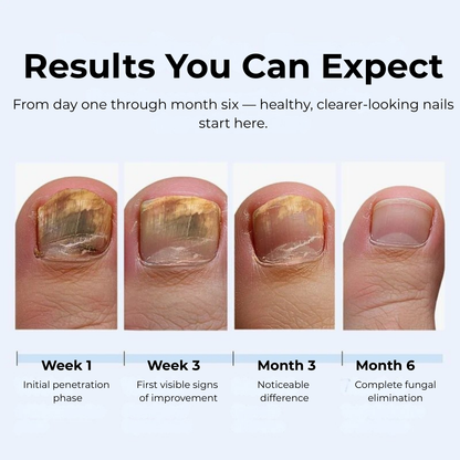 MyCurePro® · Eliminates fungi on feet and hands · 7 days